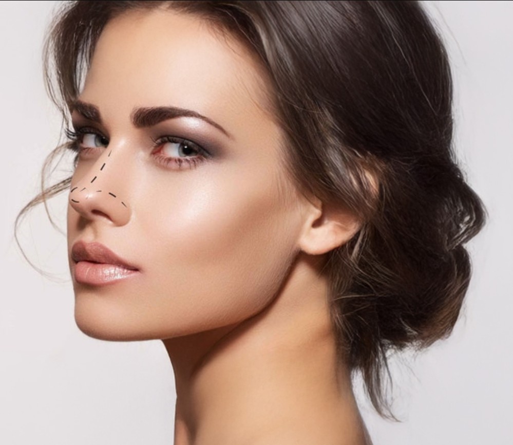 Kayseri burun ameliyatı